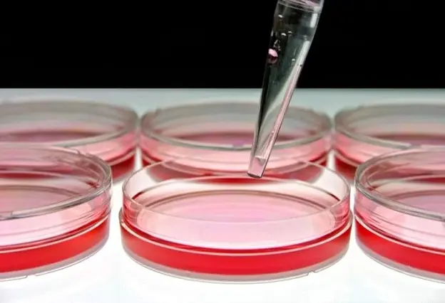 besiyeri hazırlama aşamaları